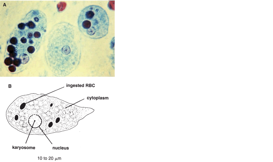<p>Name the protozoan</p>