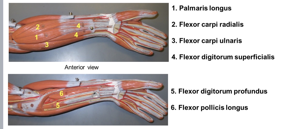 <p>Origin- medial epicondyle</p><p>Action- flexes and adducts hand</p>