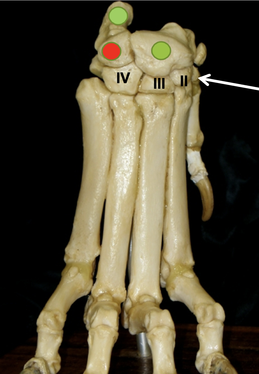<p>Name the bones of the carpus </p>