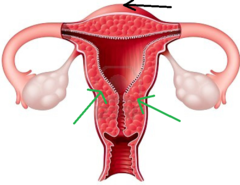 <p>- Middle layer of thick muscle</p><p>- Most muscle fibers are concentrated in the upper uterus, and their number diminishes progressively toward the cervix. The myometrium contains 2 types of smooth muscle fibers, each with specific functions in childbearing:</p><p>- Longitudinal </p><p>- Interlacing figure-8 fibers </p><p>- Circular fibers</p>