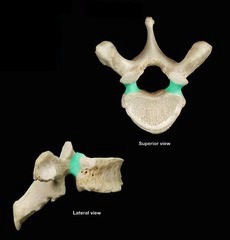 <p>What is the indicated part and vertebrae?</p>