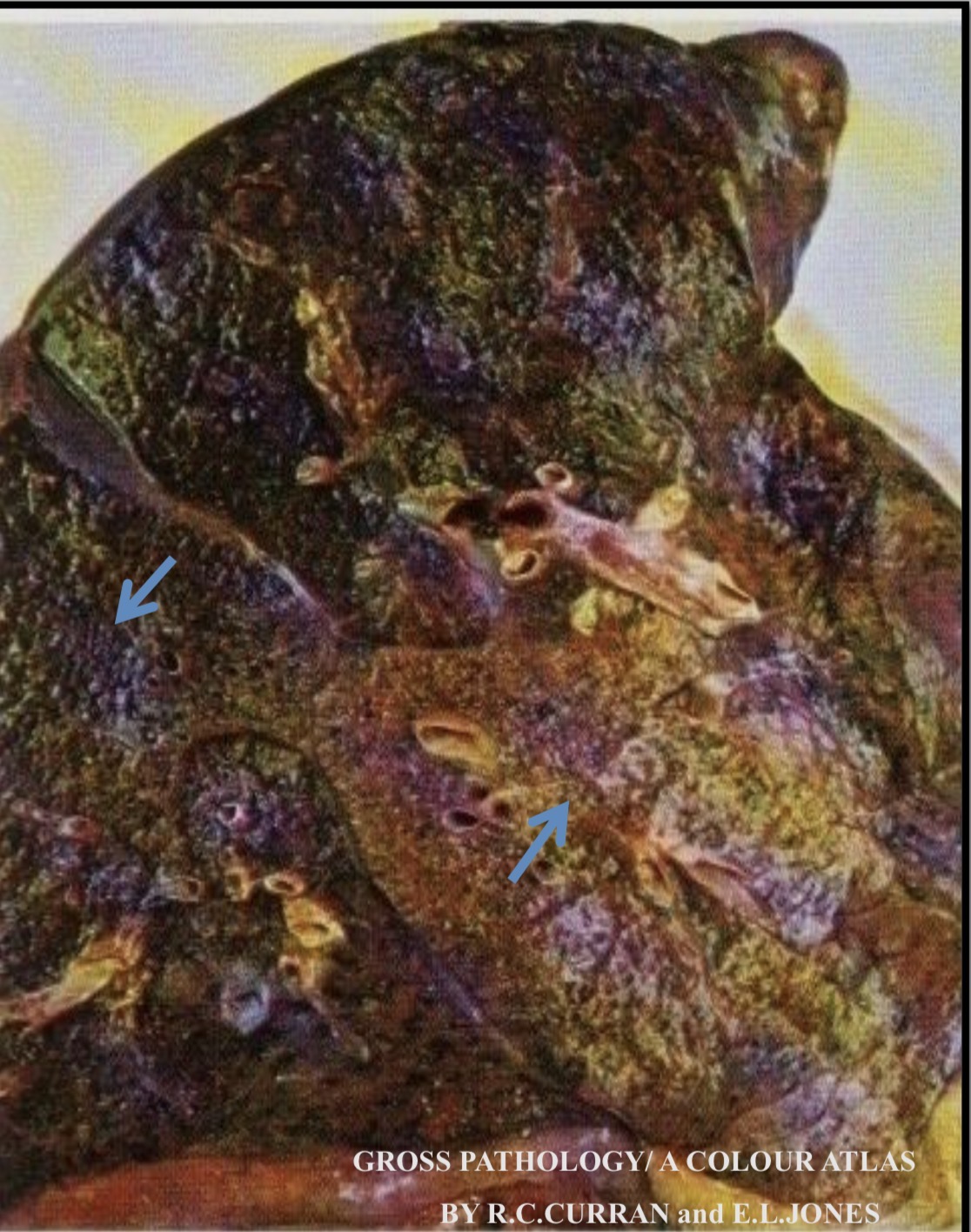 term image