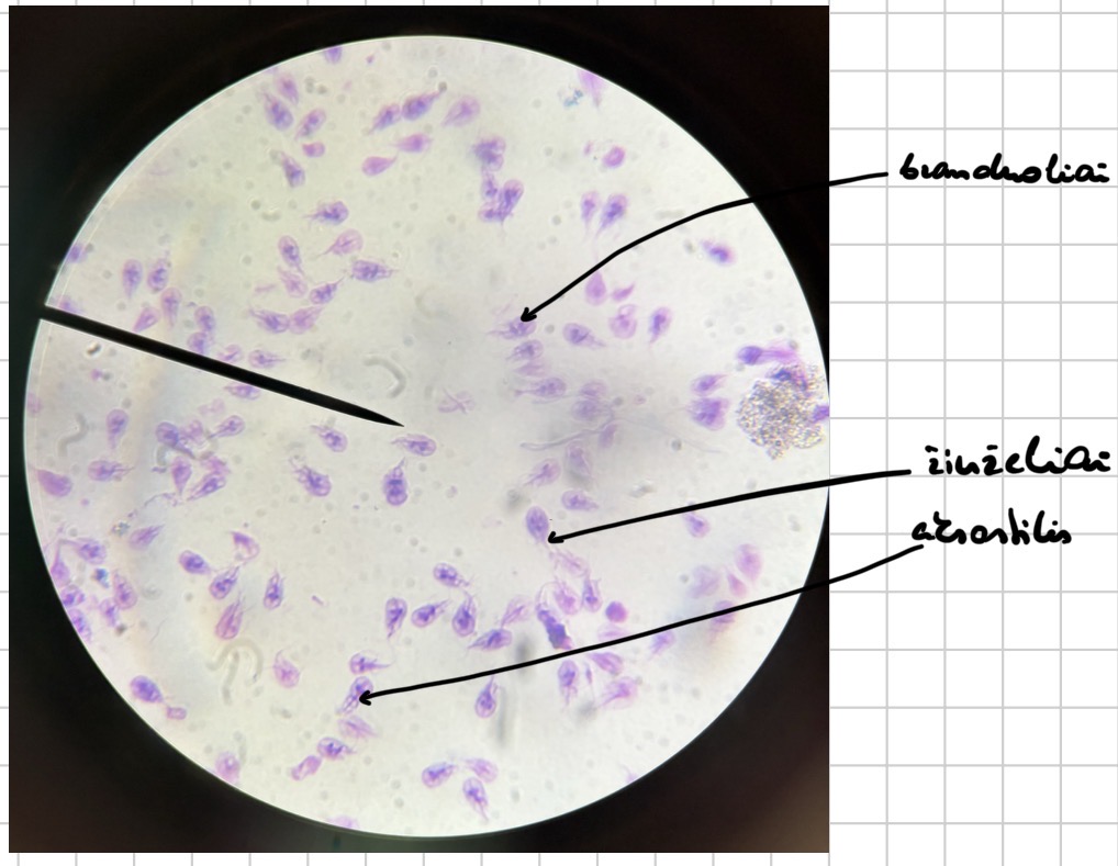 <p>Lamblijos trofozoitai - giardia lambia</p>