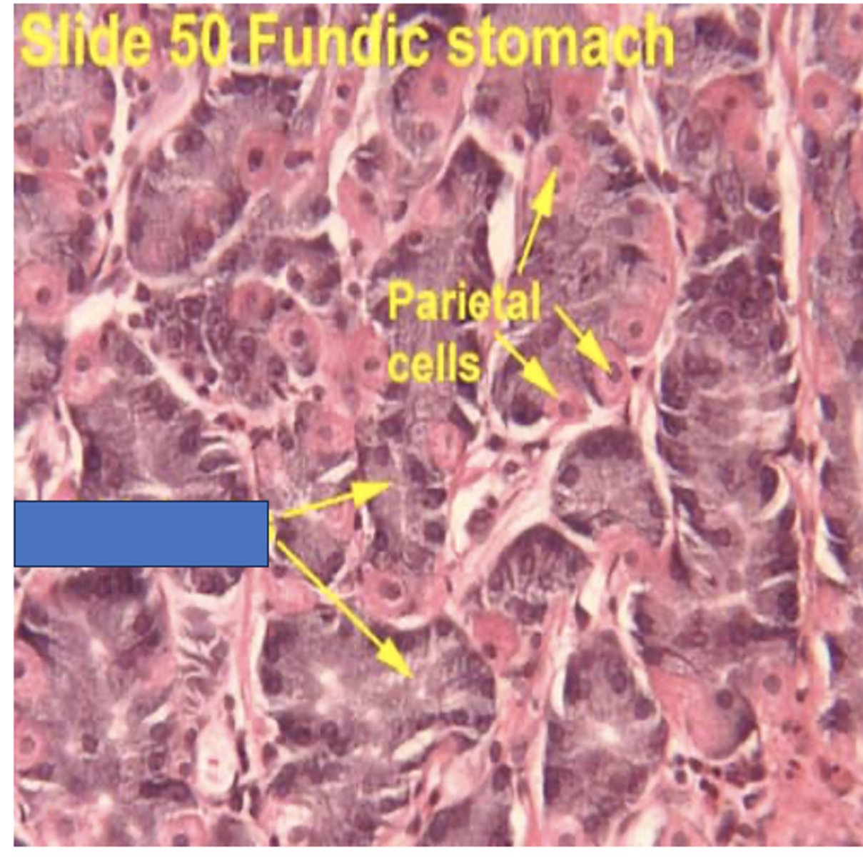 <p>Identify the cells</p>