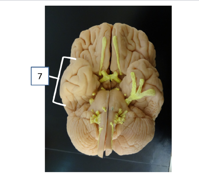 <p>What structure is #7</p>