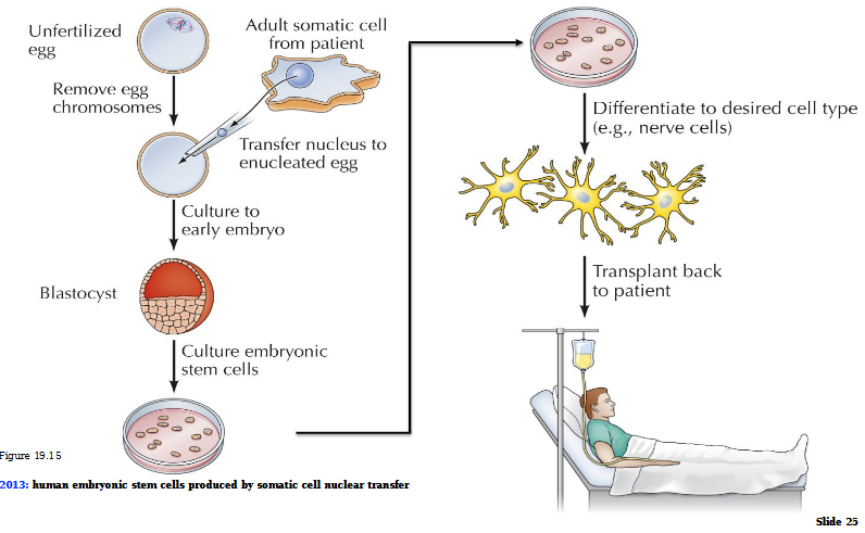 <p>Unfertilized egg with chromosomes removed</p><p>Transfer of nucleus to nucleated egg</p><p>Culture to early embryo = blastocyte</p><p>Culture embryonic stem cells</p><p>Differentiate to desired cell type (ex. neurons)</p><p>Transplant back to patient</p>