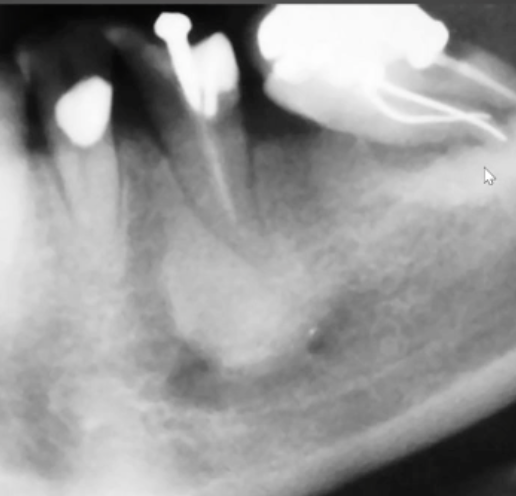 <p>most likely diagnosis? </p>