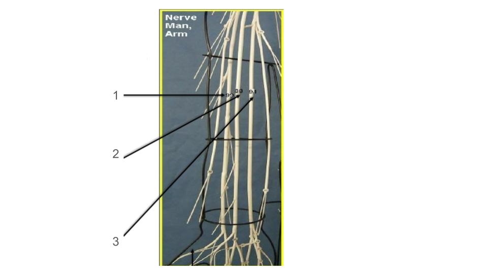 <p>3, nerve</p>