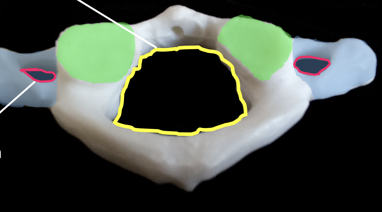 <p>what is the green region highlighted on the C1, atlas?</p>