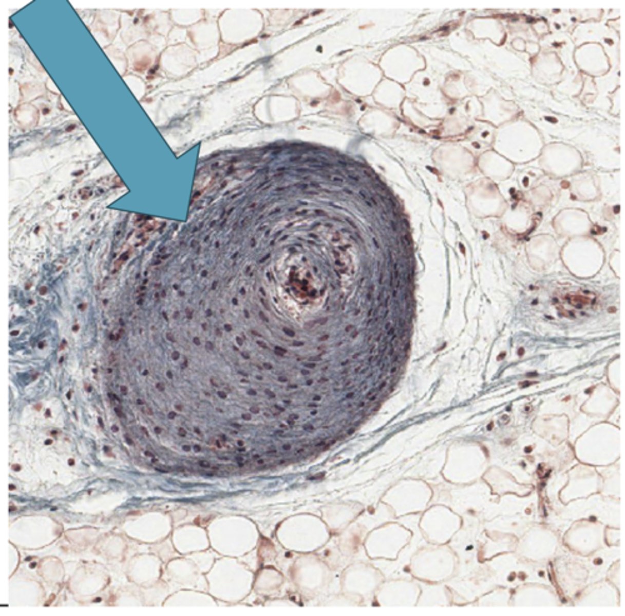 <p>Identify the structure</p>