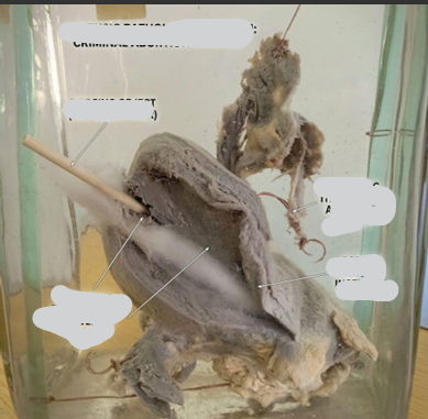 <p>Questions</p><ol><li><p>What organs are included in this specimen?</p></li><li><p>What is the estimated gestational age based on uterus size?</p></li><li><p>What finding inside the uterus proves a criminal abortion, and what is the causative instrument?</p></li><li><p>How is the time of death estimated?</p></li><li><p>What is the cause of death?</p></li><li><p>What is the final diagnosis?</p></li></ol><div data-type="horizontalRule"><hr></div><p></p><p></p>