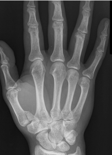 <p>What is the diagnosis?</p>