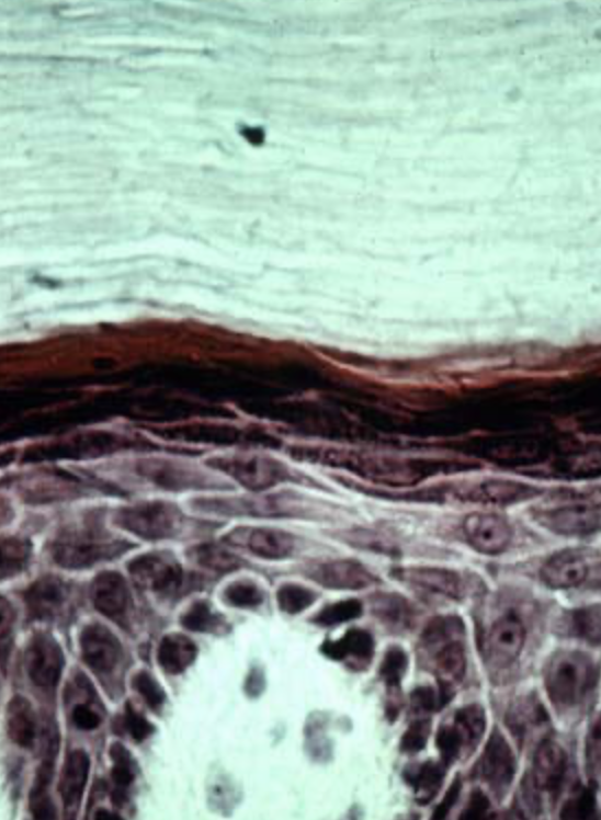 <p>tissue type </p>