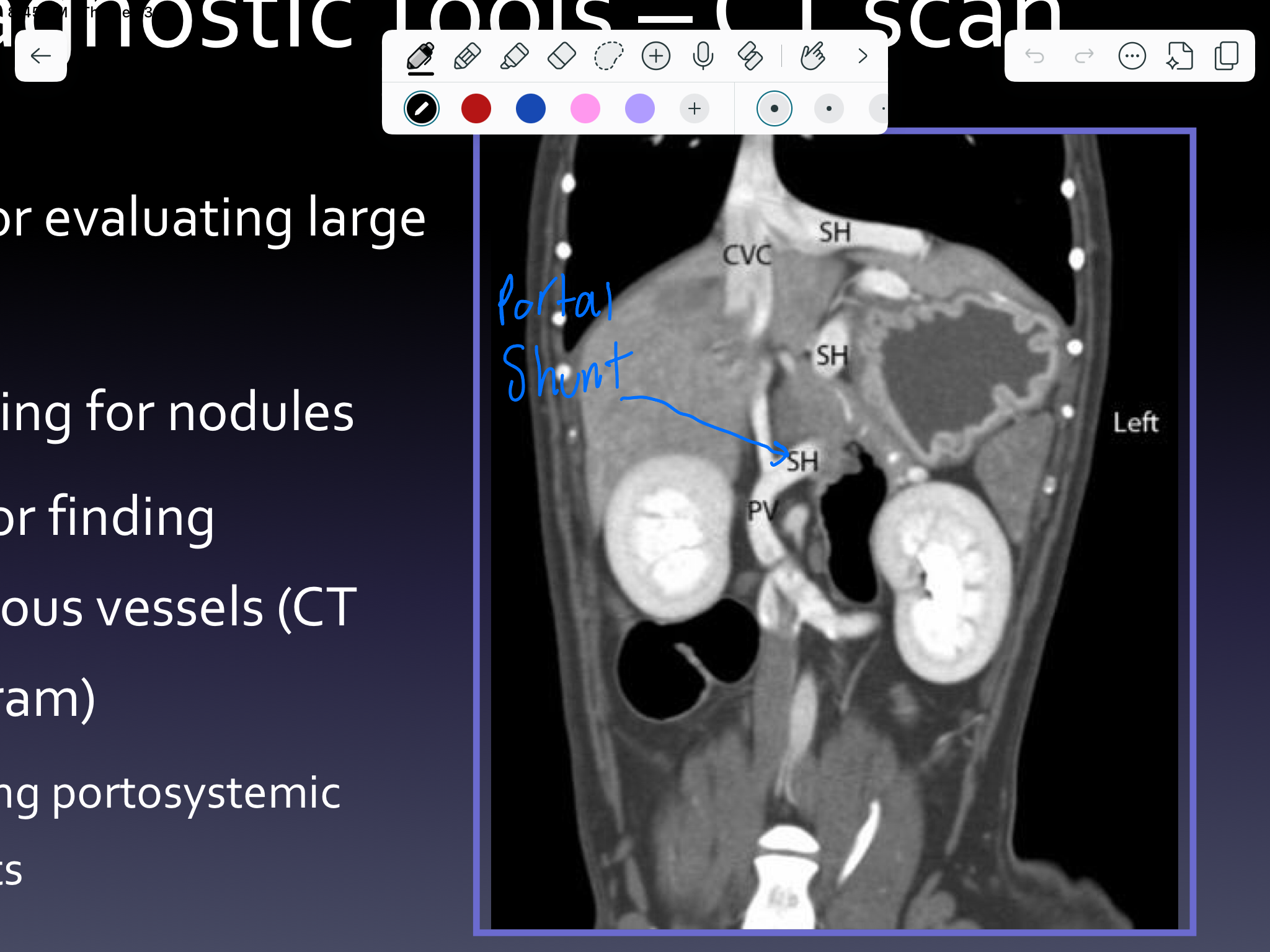 <p>CT</p>