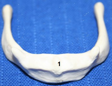 <p>What is this bone?</p>