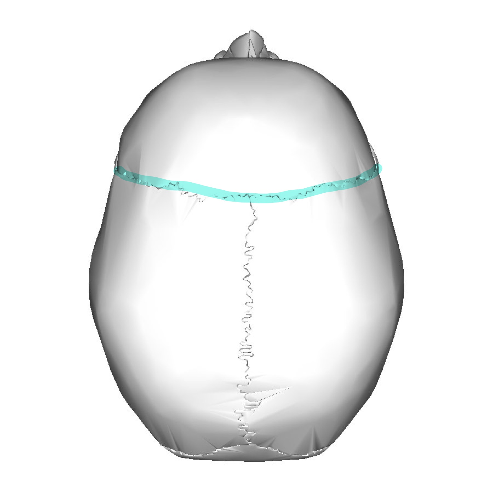 <p>What is the highlighted suture</p>