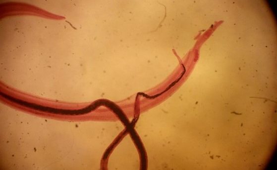 <p>Name a <strong>helminth </strong>that can be <strong>transmitted </strong>through <strong>water contact</strong></p>