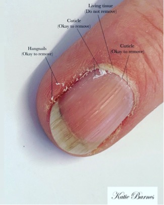 <p>Eponychium/Cuticle</p>