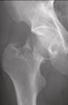 <p>localizacion?</p>