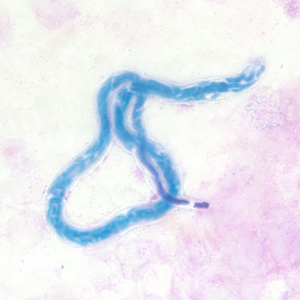 unsheathed, thin pointed tail without nuclei