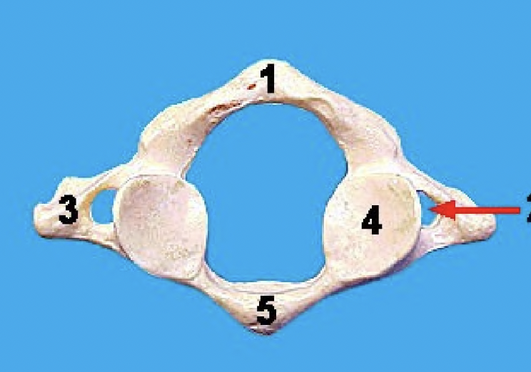 <p>what vertebra is this and what view</p>