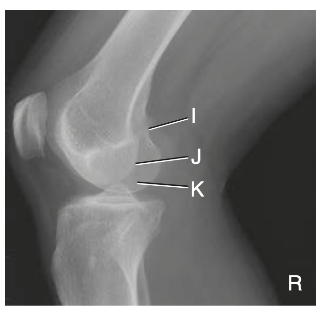 <p>I</p>