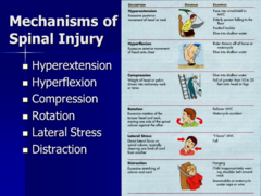 <p>- hyperextension</p><p>- hyperflexion</p><p>- compression</p><p>- rotation</p><p>- lateral stress</p><p>- distraction</p>