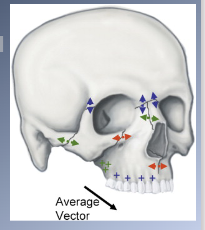 <p><span>1. Passive displacement by growth of the cranial base</span><br><span>2. Active growth of the maxillary structures and the nose</span><br><span>3. Surface remodeling</span></p>