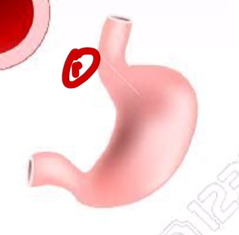 <p><strong>H2 Receptors</strong> are found in?</p>