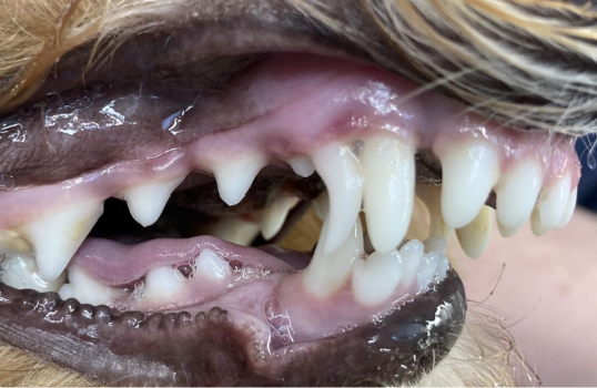 <p>Q: In cases of ……, the mandible is shorter than normal, which is commonly known as an "overbite". </p><p>A. Mandibular prognathism </p><p>B. Mandibular brachygnathism </p><p>C. Mandibular symphysis </p><p>D. Maxillary prognathism</p>