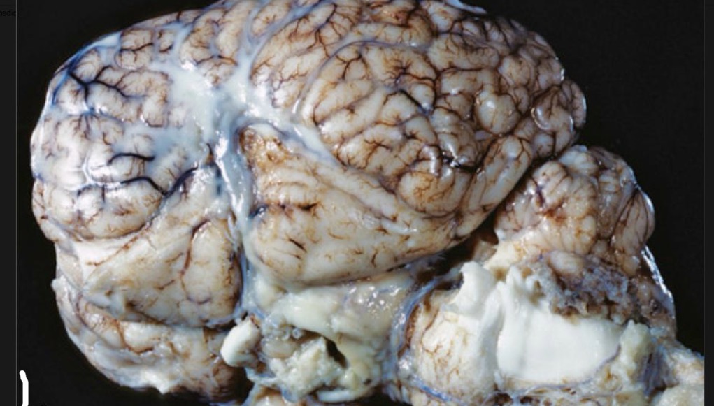 <p>morph this tissue from a horse</p>