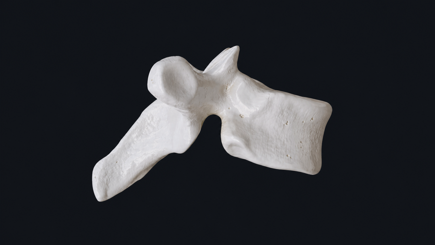 <p>Where is the Transverse Costal facet, what vertebrae only has this </p>
