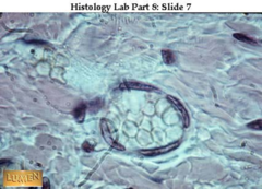 <p>Epithelial: lines airsacs of lungs & capillaries</p><p>Single thin layer allows for easy diffusion of substance</p>