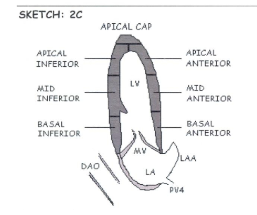 <p>Ap2ch Diagram </p>