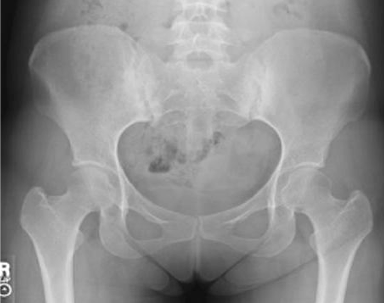 <p>What is the most likely Dx</p>