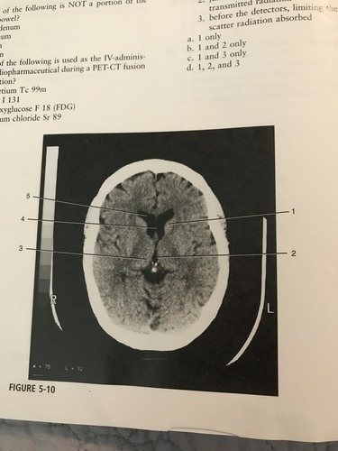 <p>Number 3 on the figure corresponds to?</p><p>A) caudate nucleus </p><p>B) thalamus</p><p>C) third ventricle</p><p>D) pineal gland</p>