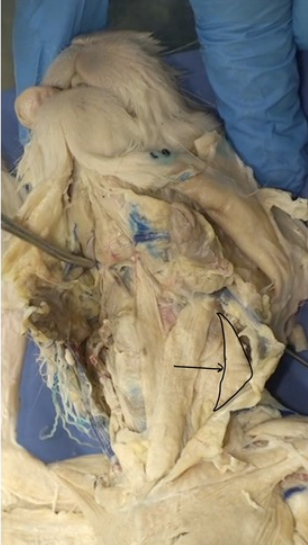 <p>What muscle is this?</p>