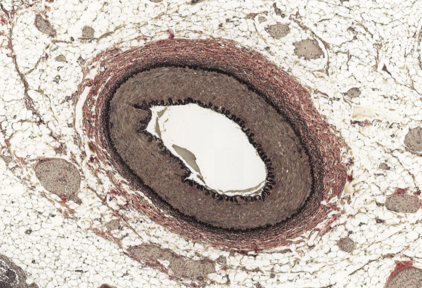 <p>Identify the Vessel and the Layer pictured</p>