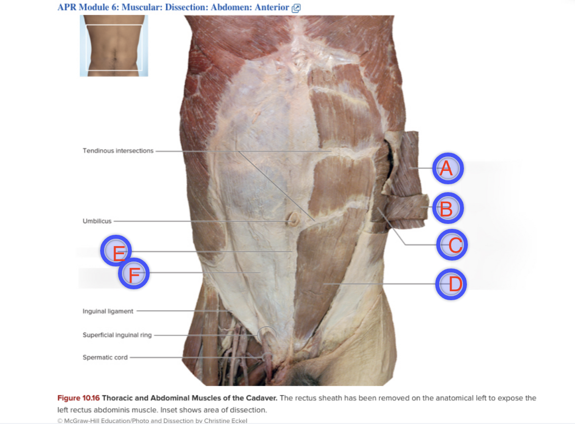 <p>what muscle is B?</p>