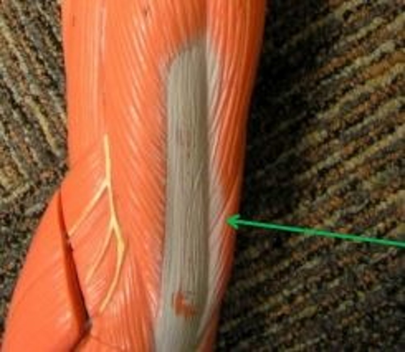 <p>O: posterior shaft of humerus</p>
