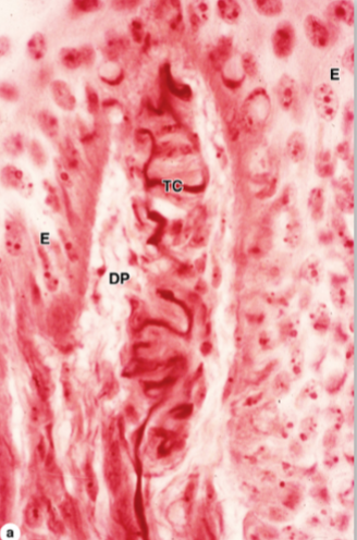 <p>What is this? What type of skin is it located in? </p>