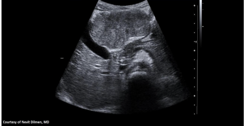 term image
