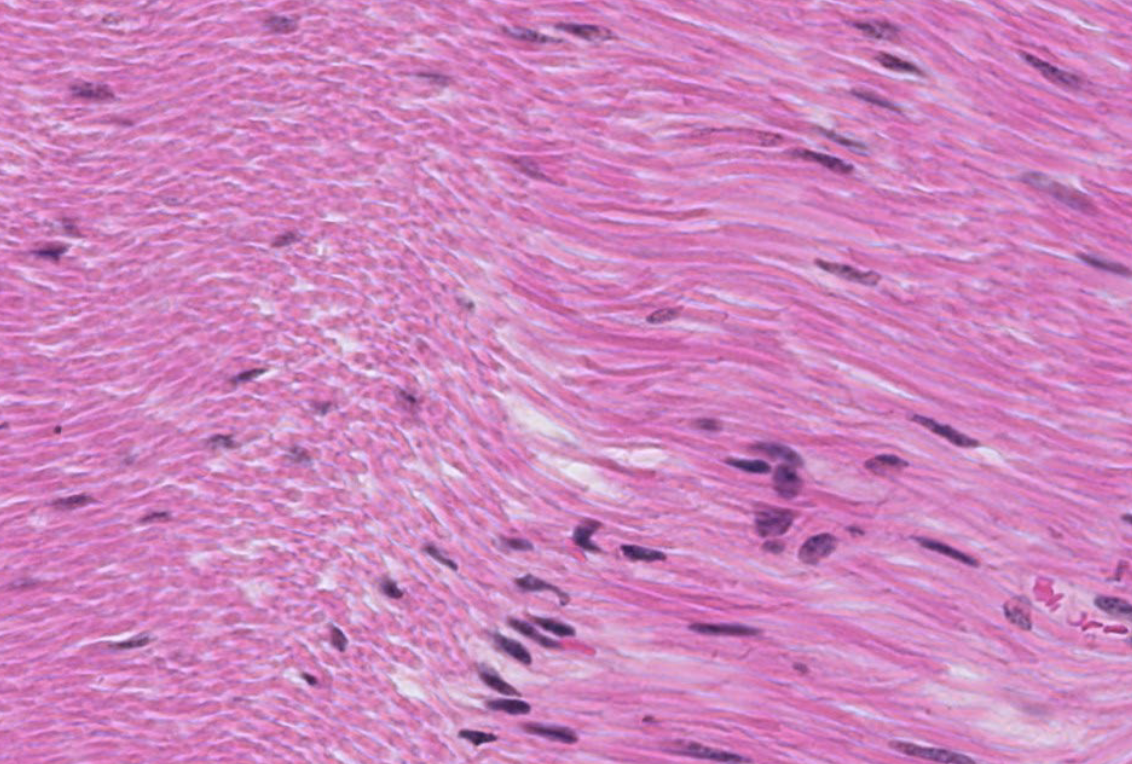 <p>what kind of dense regular CT is shown here (hint: hills and valleys when contracted)</p>