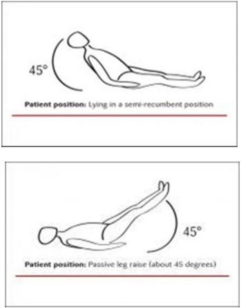 <p>pt raise head/legs 45° →</p><ul><li><p>if ↑ SV → tx w/ fluids</p></li><li><p>if SV (—) → tx w/ vasopressors</p></li></ul><p></p>