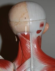<p>A: maintaining balance of the head on the neck</p><p>O: transverse process of C7-T12</p><p>I: occipital bone (capitis) and spinous processes of cervical vertebrae</p>