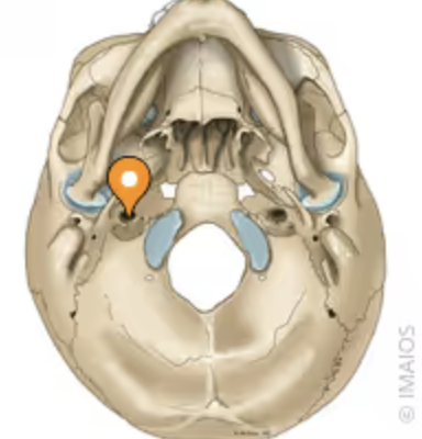 <p>a bony passage in the skull’s temporal bone that allows the main blood supply to the brain to pass safely from the neck into the head</p>