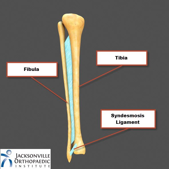 <p>[Fibrous Joints]</p><p>Syndesmosis</p>