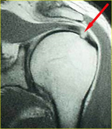 <p>What is the diagnosis?</p>
