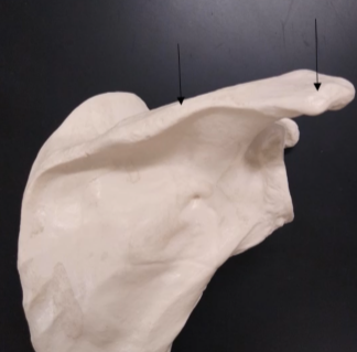 <p>What is this on the top right?</p>