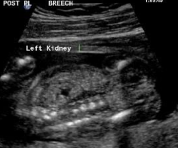 <p>what plane was this taken in?</p>